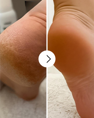 Creme de pés suavizante Nutridome com ureia e manteiga de karité - 4
