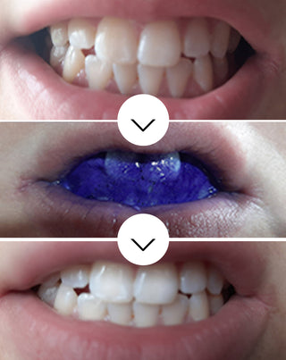 White Bite Smilebite soro de correção da cor dos dentes 30 ml - 3