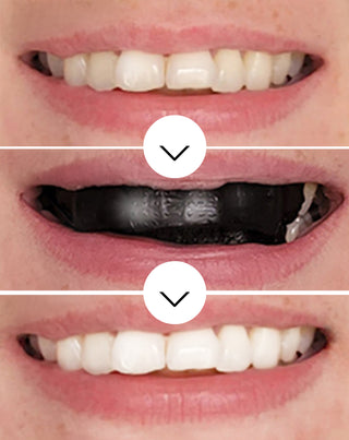 O conjunto de 28 tiras de branqueamento dentário White(ning) Stripes Smilebite. - 3