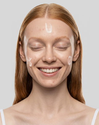 Creme antiacne de dia com ácido salicílico e azelaico para imperfeições Anti-Acne Orphica Clinic 50 ml - 2