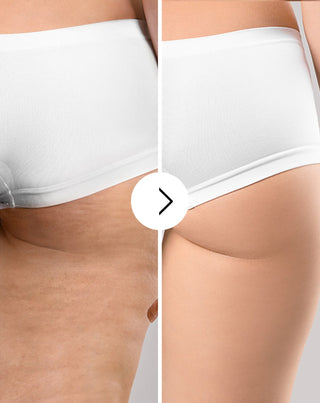 Comprimidos para melhorar a celulite e a pele com extractos naturais Cellinea 60 cápsulas - 4