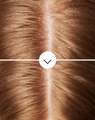 Champô anti-caspa para cabelo com piroctona olamina com ação hidratante Nutridome - 5